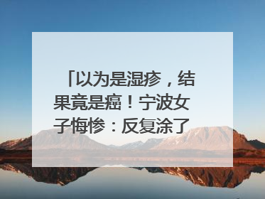 以为是湿疹，结果竟是癌！宁波女子悔惨：反复涂了一年药膏都没好！很多患者首诊都去了皮肤科